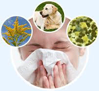 Allergies